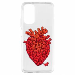 Xiaomi Redmi Note 11