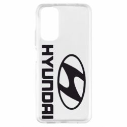 Xiaomi Redmi Note 11