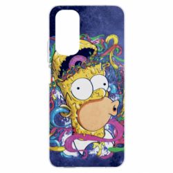 Xiaomi Redmi Note 11