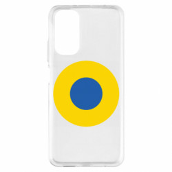 Xiaomi Redmi Note 11