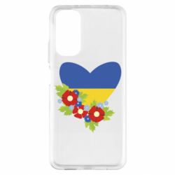 Xiaomi Redmi Note 11