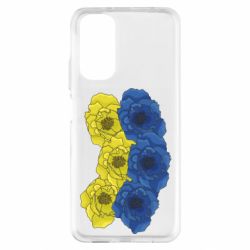 Xiaomi Redmi Note 11