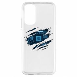 Xiaomi Redmi Note 11