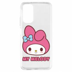 Xiaomi Redmi Note 11