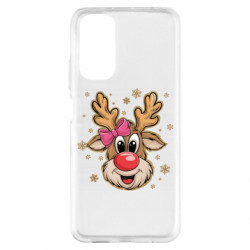 Xiaomi Redmi Note 11