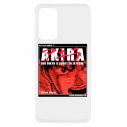 Xiaomi Redmi Note 11 Pro/Note 11 Pro 5G/Note 12 Pro 4G