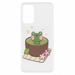 Xiaomi Redmi Note 11 Pro/Note 11 Pro 5G/Note 12 Pro 4G