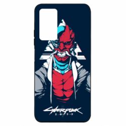 Xiaomi Redmi Note 11 Pro/Note 11 Pro 5G/Note 12 Pro 4G