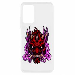 Xiaomi Redmi Note 11 Pro/Note 11 Pro 5G/Note 12 Pro 4G