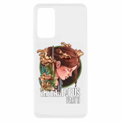 Xiaomi Redmi Note 11 Pro/Note 11 Pro 5G/Note 12 Pro 4G