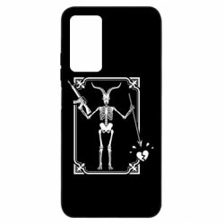 Xiaomi Redmi Note 11 Pro/Note 11 Pro 5G/Note 12 Pro 4G