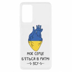 Xiaomi Redmi Note 11 Pro/Note 11 Pro 5G/Note 12 Pro 4G