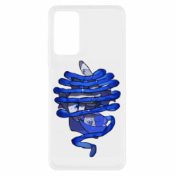 Xiaomi Redmi Note 11 Pro/Note 11 Pro 5G/Note 12 Pro 4G