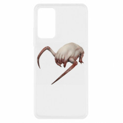 Xiaomi Redmi Note 11 Pro/Note 11 Pro 5G/Note 12 Pro 4G