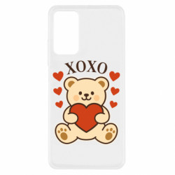 Xiaomi Redmi Note 11 Pro/Note 11 Pro 5G/Note 12 Pro 4G