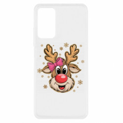 Xiaomi Redmi Note 11 Pro/Note 11 Pro 5G/Note 12 Pro 4G