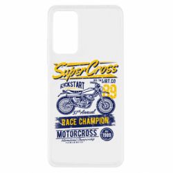 Xiaomi Redmi Note 11 Pro/Note 11 Pro 5G/Note 12 Pro 4G