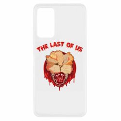 Xiaomi Redmi Note 11 Pro/Note 11 Pro 5G/Note 12 Pro 4G