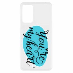 Xiaomi Redmi Note 11 Pro/Note 11 Pro 5G/Note 12 Pro 4G