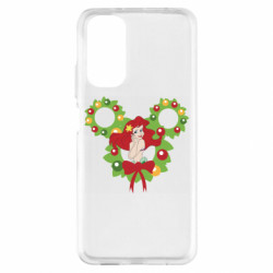 Xiaomi Redmi Note 11