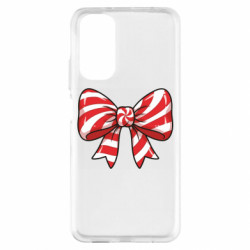 Xiaomi Redmi Note 11