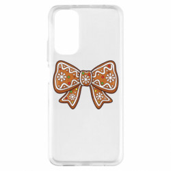 Xiaomi Redmi Note 11