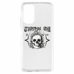 Xiaomi Redmi Note 11