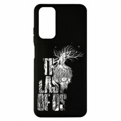 Xiaomi Redmi Note 11