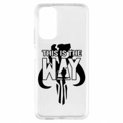 Xiaomi Redmi Note 11