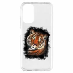 Xiaomi Redmi Note 11