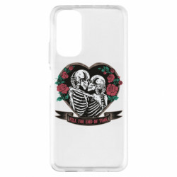 Xiaomi Redmi Note 11