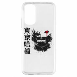 Xiaomi Redmi Note 11