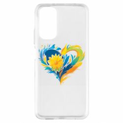 Xiaomi Redmi Note 11