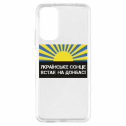 Xiaomi Redmi Note 11