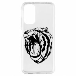 Xiaomi Redmi Note 11