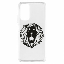 Xiaomi Redmi Note 11