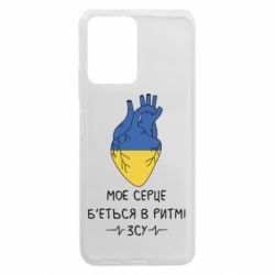 Xiaomi Redmi Note 12 5G/Poco X5 5G