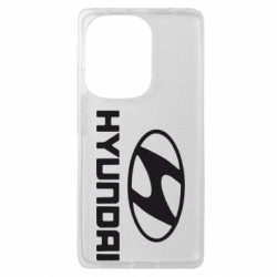 Xiaomi Redmi Note 13 Pro 4G