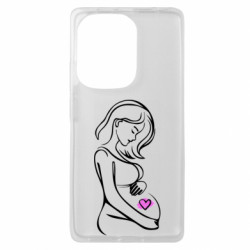 Чохол з розділу Вагітним в очікувані чуда для Xiaomi Redmi Note 13 Pro 4G - FATLINE Чохол з розділу Вагітним в очікувані чуда для Xiaomi Redmi Note 13 Pro 4G